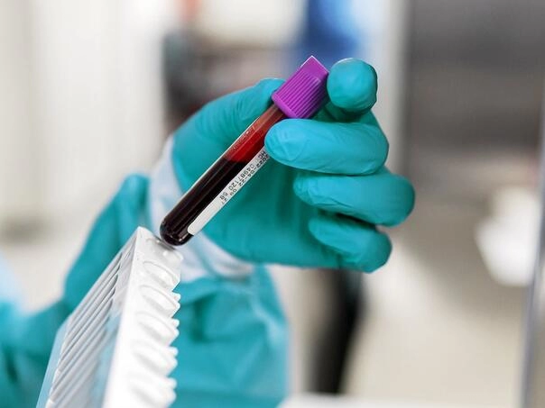 Napredni test krvi za više od 50 vrsta raka pokazao obećavajuće rezultate